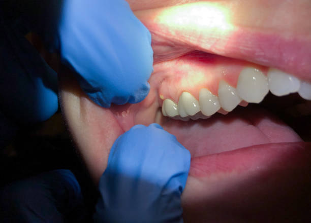  Skyline, AL Emergency Dentist Pros