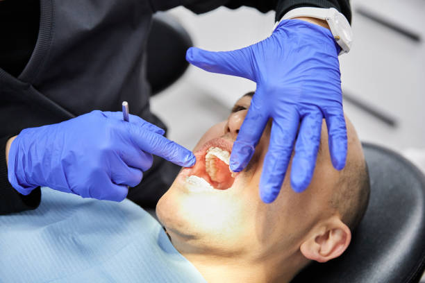 Best Emergency Broken Tooth Repair in Skyline, AL